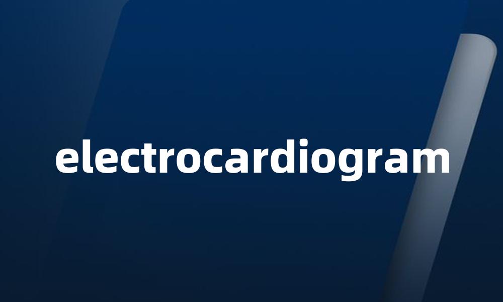 electrocardiogram